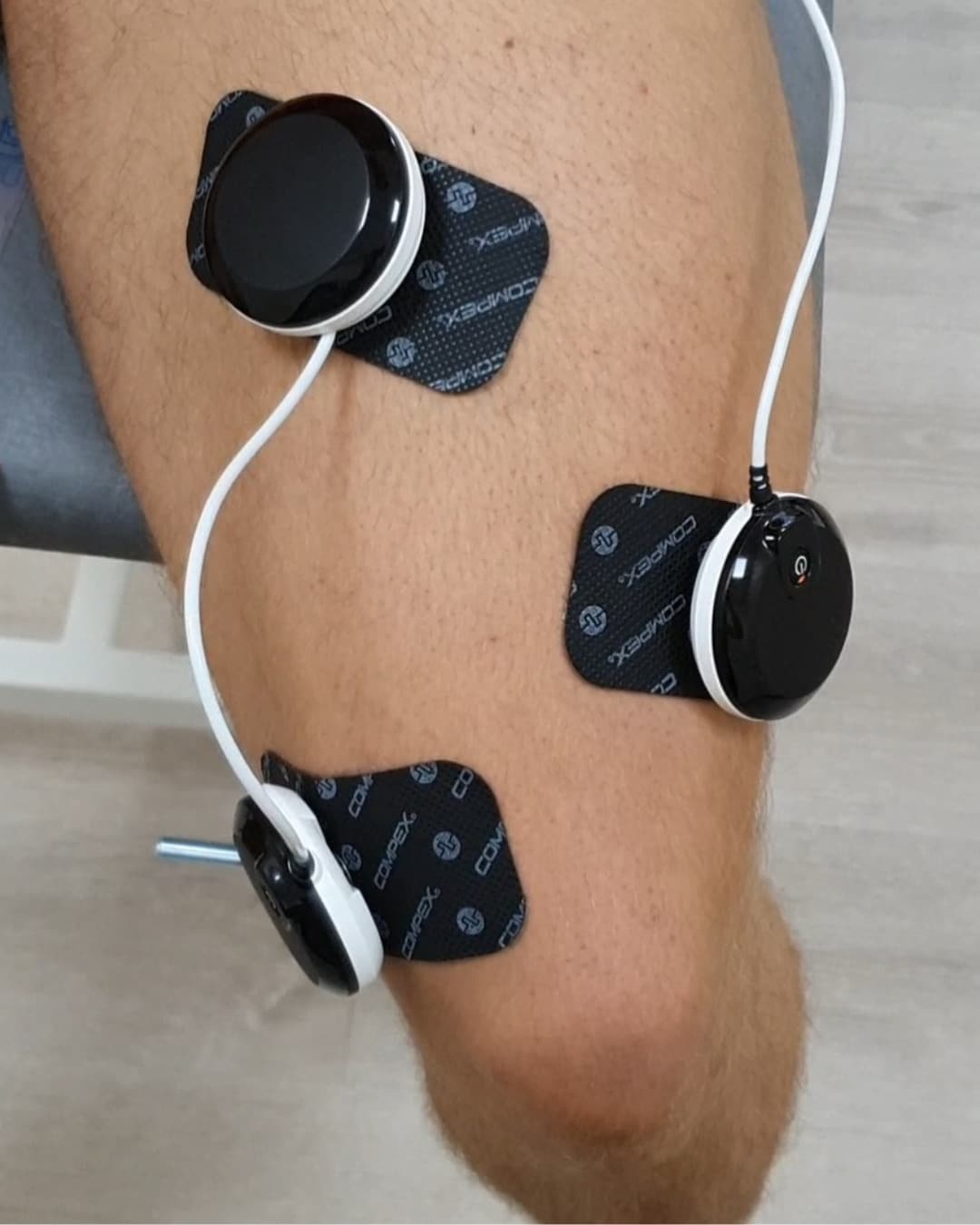 Elektriskā muskuļu stimulācija